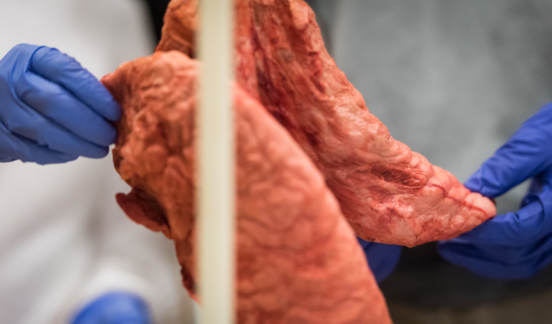 Wake Forest School of Medicine Rolling Bones